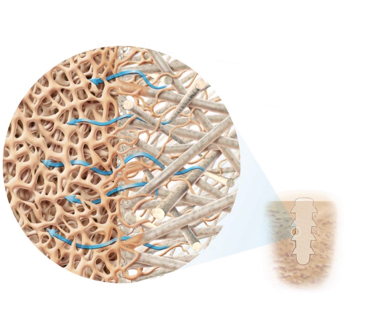 Illustration of a bio-integrative implant supporting bone